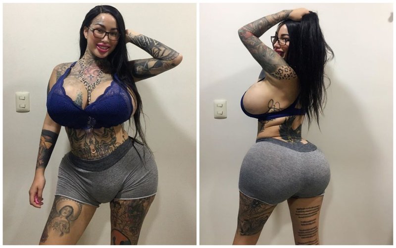 Big Women Butt Implant